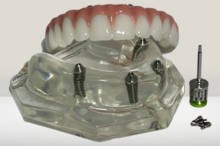 EndodontiatratamentodecanalRC2